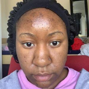 African Black Soap Cleanser with Shea Butter, Aloe Vera & Tea Tree | For Acne-Prone, Sensitive & Dry Skin